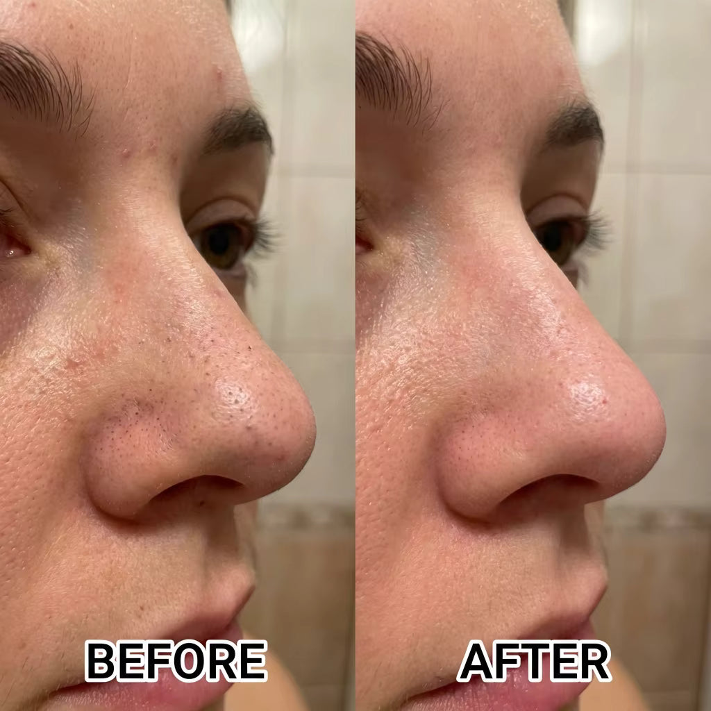 Charcoal Peel-Off Mask