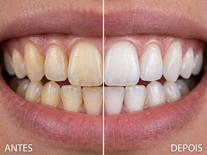 Professional Whitening Toothpaste 30ml