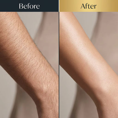 Body & Face Laser Hair Removal