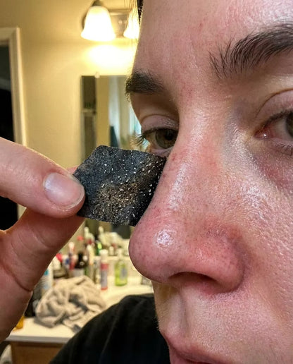 Blackhead removal strips