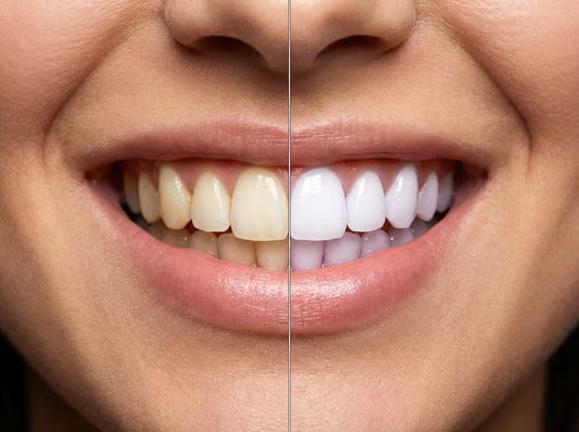 Tooth Whitening Strips