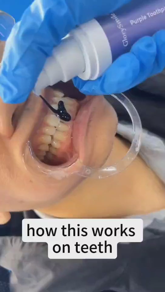 Professional Whitening Toothpaste 30ml